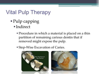 Vital Pulp Therapy
  Pulp capping
    Indirect
     Procedure in which a material is placed on a thin
      partition of remaining carious dentin that if
      removed might expose the pulp.
     Step-Wise Excavation of Caries.
 
