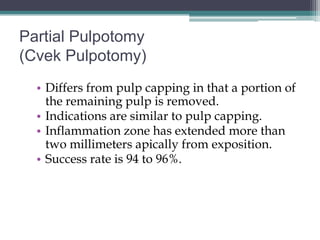 Partial Pulpotomy
(Cvek Pulpotomy)
  • Differs from pulp capping in that a portion of
    the remaining pulp is removed.
  • Indications are similar to pulp capping.
  • Inflammation zone has extended more than
    two millimeters apically from exposition.
  • Success rate is 94 to 96%.
 