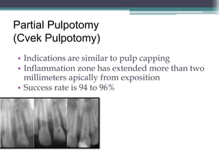 Partial Pulpotomy
(Cvek Pulpotomy)
• Indications are similar to pulp capping
• Inflammation zone has extended more than two
  millimeters apically from exposition
• Success rate is 94 to 96%
 