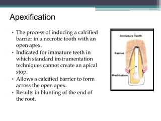 Apexification
• The process of inducing a calcified
  barrier in a necrotic tooth with an
  open apex.
• Indicated for immature teeth in
  which standard instrumentation
  techniques cannot create an apical
  stop.
• Allows a calcified barrier to form
  across the open apex.
• Results in blunting of the end of
  the root.
 