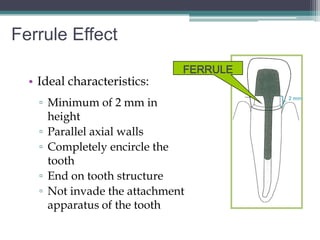 Ferrule Effect
                              FERRULE
  • Ideal characteristics:
    ▫ Minimum of 2 mm in
                                        2 mm


      height
    ▫ Parallel axial walls
    ▫ Completely encircle the
      tooth
    ▫ End on tooth structure
    ▫ Not invade the attachment
      apparatus of the tooth
 