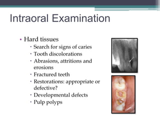 Intraoral Examination
  • Hard tissues
      Search for signs of caries
      Tooth discolorations
      Abrasions, attritions and
       erosions
      Fractured teeth
      Restorations: appropriate or
       defective?
      Developmental defects
      Pulp polyps
 