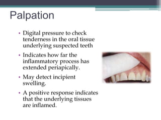 Palpation
 • Digital pressure to check
   tenderness in the oral tissue
   underlying suspected teeth
 • Indicates how far the
   inflammatory process has
   extended periapically.
 • May detect incipient
   swelling.
 • A positive response indicates
   that the underlying tissues
   are inflamed.
 