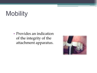 Mobility

  • Provides an indication
    of the integrity of the
    attachment apparatus.
 