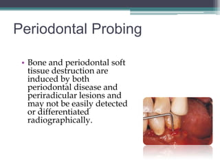 Periodontal Probing

 • Bone and periodontal soft
   tissue destruction are
   induced by both
   periodontal disease and
   periradicular lesions and
   may not be easily detected
   or differentiated
   radiographically.
 