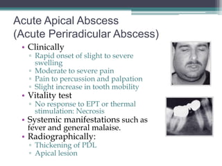 Acute Apical Abscess
(Acute Periradicular Abscess)
 • Clinically
   ▫ Rapid onset of slight to severe
     swelling
   ▫ Moderate to severe pain
   ▫ Pain to percussion and palpation
   ▫ Slight increase in tooth mobility
 • Vitality test
   ▫ No response to EPT or thermal
     stimulation: Necrosis
 • Systemic manifestations such as
  fever and general malaise.
 • Radiographically:
   ▫ Thickening of PDL
   ▫ Apical lesion
 