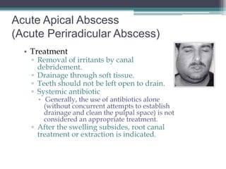 Acute Apical Abscess
(Acute Periradicular Abscess)
  • Treatment
   ▫ Removal of irritants by canal
     debridement.
   ▫ Drainage through soft tissue.
   ▫ Teeth should not be left open to drain.
   ▫ Systemic antibiotic
      Generally, the use of antibiotics alone
       (without concurrent attempts to establish
       drainage and clean the pulpal space) is not
       considered an appropriate treatment.
   ▫ After the swelling subsides, root canal
     treatment or extraction is indicated.
 