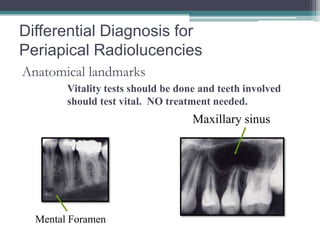 Differential Diagnosis for
Periapical Radiolucencies
Anatomical landmarks
        Vitality tests should be done and teeth involved
        should test vital. NO treatment needed.
                                    Maxillary sinus




  Mental Foramen
 