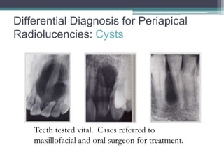 Differential Diagnosis for Periapical
Radiolucencies: Cysts




    Teeth tested vital. Cases referred to
    maxillofacial and oral surgeon for treatment.
 