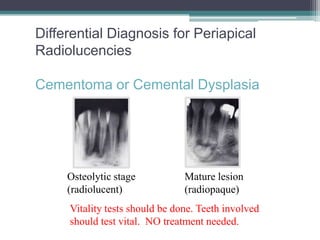 Differential Diagnosis for Periapical
Radiolucencies

Cementoma or Cemental Dysplasia




     Osteolytic stage           Mature lesion
     (radiolucent)              (radiopaque)
     Vitality tests should be done. Teeth involved
     should test vital. NO treatment needed.
 
