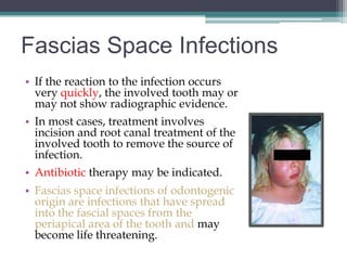 Fascias Space Infections
• If the reaction to the infection occurs
  very quickly, the involved tooth may or
  may not show radiographic evidence.
• In most cases, treatment involves
  incision and root canal treatment of the
  involved tooth to remove the source of
  infection.
• Antibiotic therapy may be indicated.
• Fascias space infections of odontogenic
  origin are infections that have spread
  into the fascial spaces from the
  periapical area of the tooth and may
  become life threatening.
 
