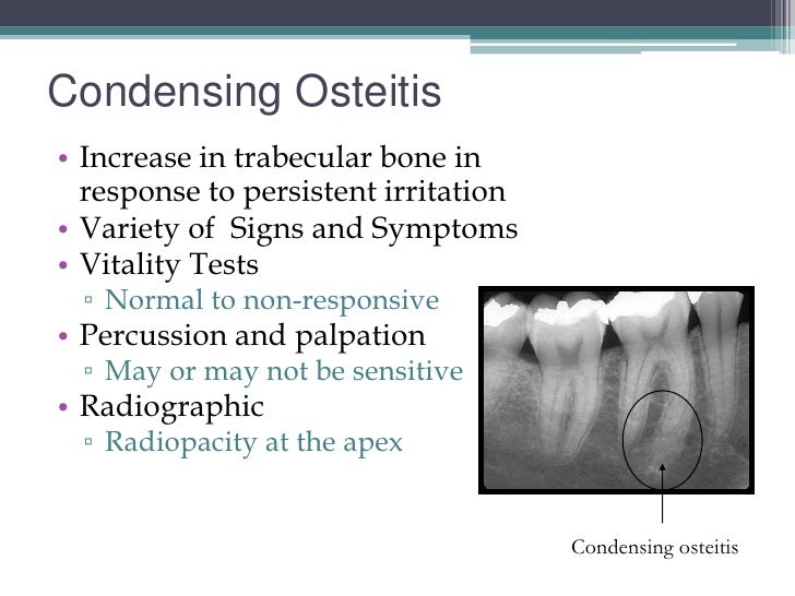 Pret 7326 nat boardreview 2012