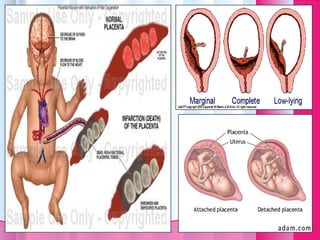 Preterm | PPT