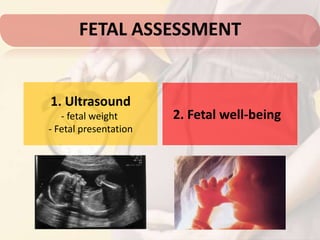 FETAL ASSESSMENT
1. Ultrasound
- fetal weight
- Fetal presentation
2. Fetal well-being
 