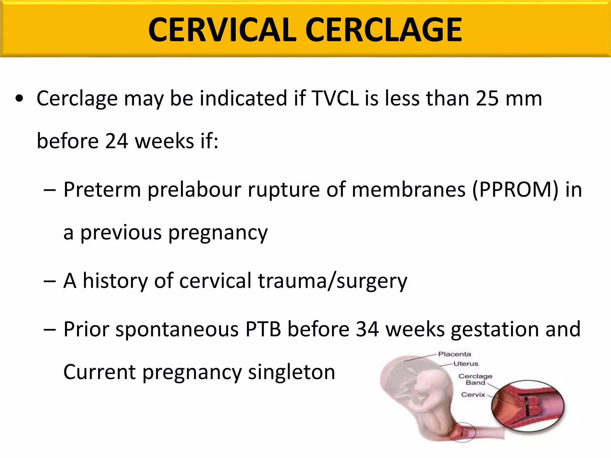 PRETERM LABOUR | PPTX