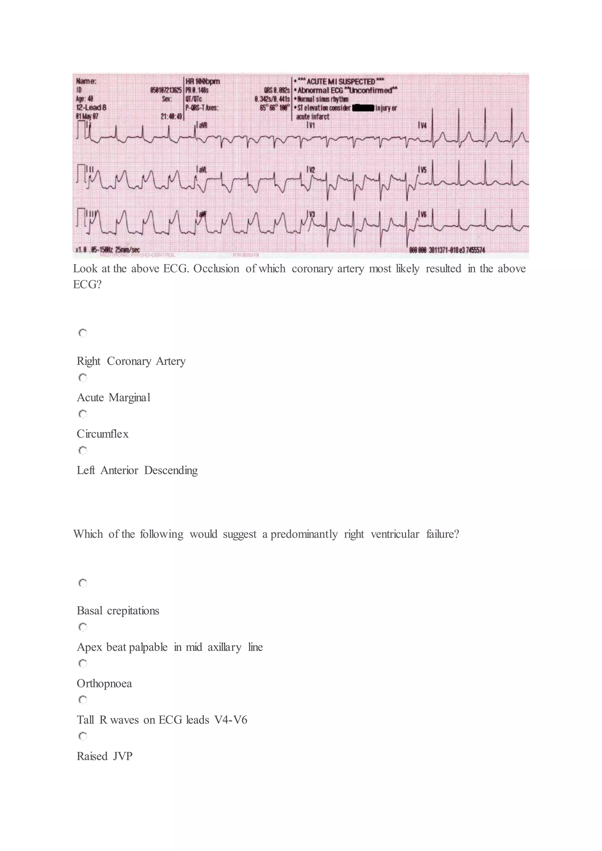 Look at the above ECG. Occlusion of which coronary artery most likely resulted in the above
ECG?
Right Coronary Artery
Acute Marginal
Circumflex
Left Anterior Descending
Which of the following would suggest a predominantly right ventricular failure?
Basal crepitations
Apex beat palpable in mid axillary line
Orthopnoea
Tall R waves on ECG leads V4-V6
Raised JVP
 