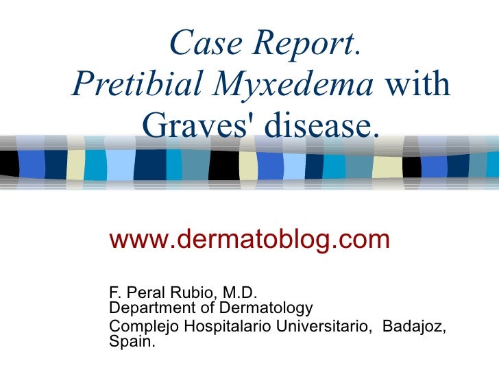 Pretibial myxedema wiyh graves disease[1].
