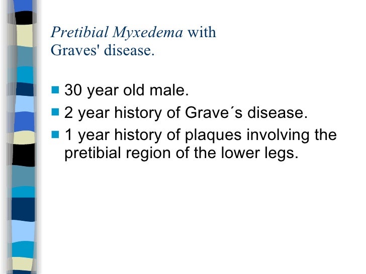 Pretibial myxedema wiyh graves disease[1].