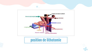 position de lithotomie
 