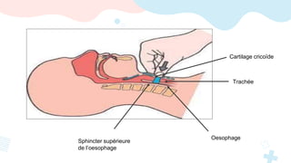 Cartilage cricoïde
Sphincter supérieure
de l’oesophage
Trachée
Oesophage
 