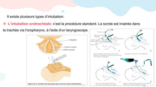  L’intubation orotrachéale: c’est la procédure standard. La sonde est insérée dans
la trachée via l'oropharynx, à l'aide d'un laryngoscope.
Il existe plusieurs types d’intubation:
 