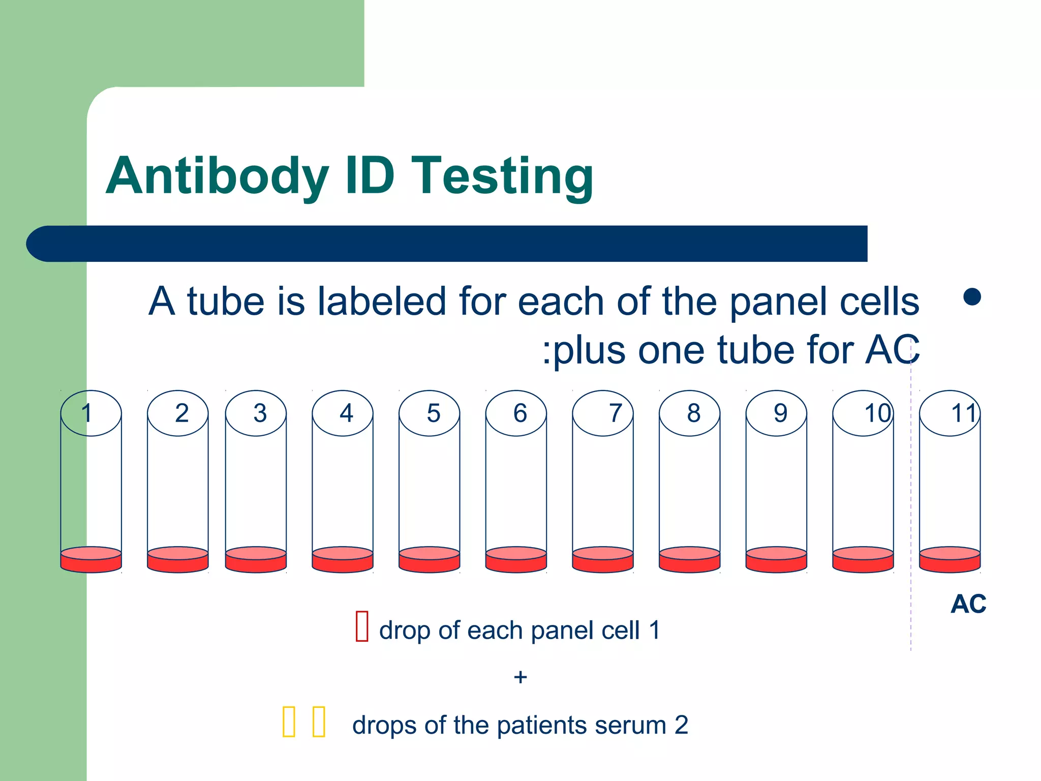 Antibody ID Testing
A tube is labeled for each of the panel cells
plus one tube for AC:
AC
1 2 3 4 5 6 7 8 9 10 11
 1drop of each panel cell
+
2drops of the patients serum 
 
