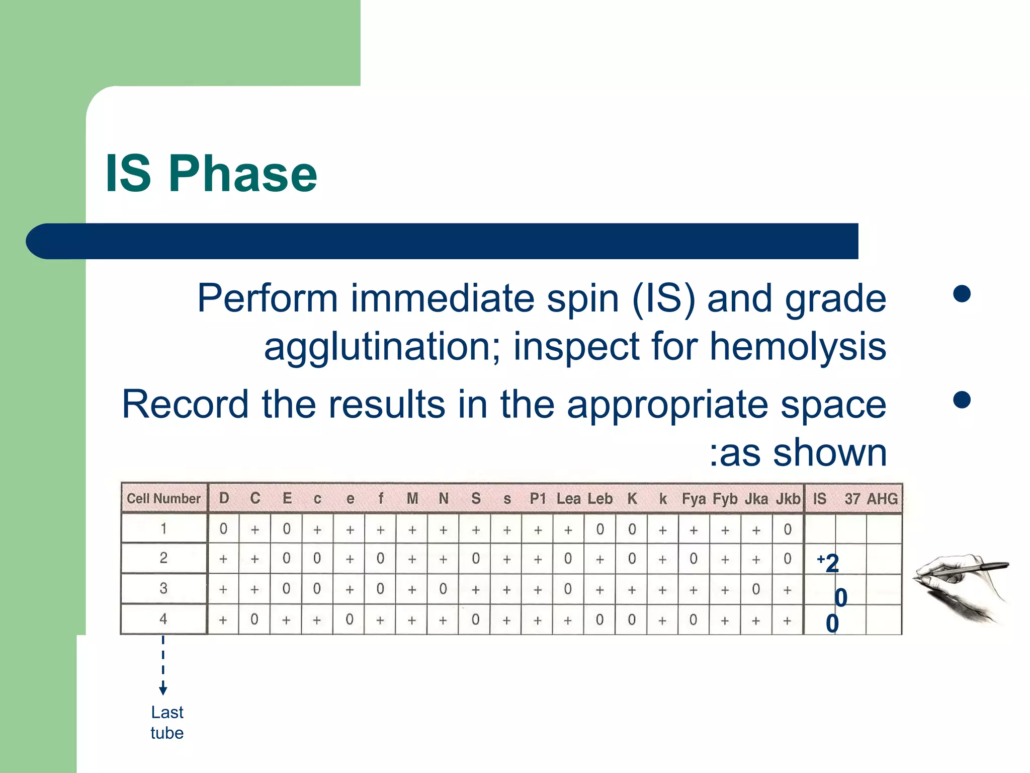 IS Phase
Perform immediate spin (IS) and grade
agglutination; inspect for hemolysis
Record the results in the appropriate space
as shown:
2+
0
0
Last
tube
 