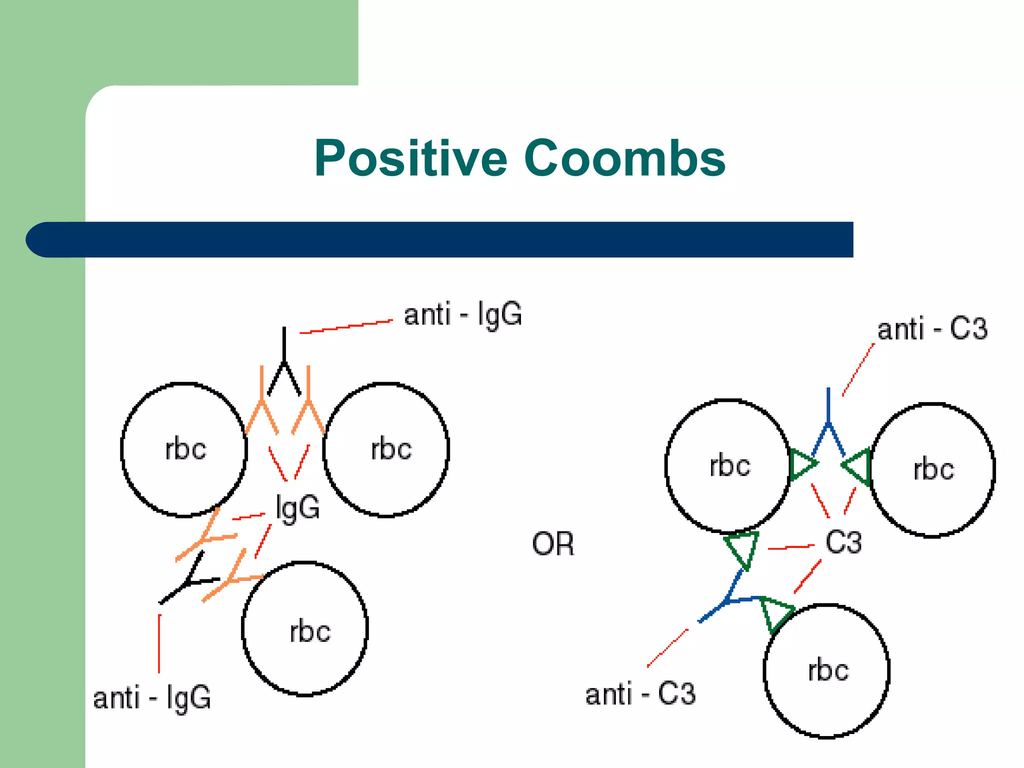 Positive Coombs
 