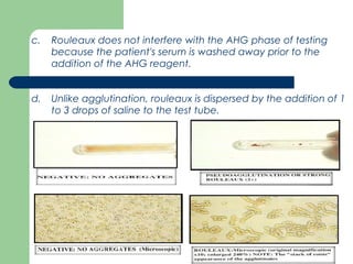‫Pretransfusion testing final- ab screening - NAGLAA MAKRAM | PPT