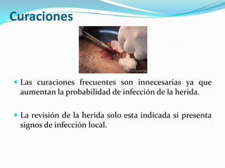 CuracionesLas curacionesfrecuentes son innecesariasyaqueaumentan la probabilidad de infección de la herida.La revisión de la herida solo estaindicadasipresentasignos de infección local.