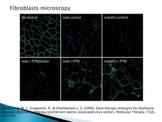 Blankinship, M. J., Gregorevic, P., & Chamberlain, J. S. (2006). Gene therapy strategies for Duchenne
muscular dystrophy utilizing recombinant adeno-associated virus vectors. Molecular Therapy, 13(2),
241-249.
 