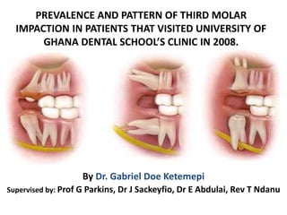 PREVALENCE AND PATTERN OF THIRD MOLAR
IMPACTION IN PATIENTS THAT VISITED UNIVERSITY OF
GHANA DENTAL SCHOOL’S CLINIC IN 2008.
By Dr. Gabriel Doe Ketemepi
Supervised by: Prof G Parkins, Dr J Sackeyfio, Dr E Abdulai, Rev T Ndanu
 