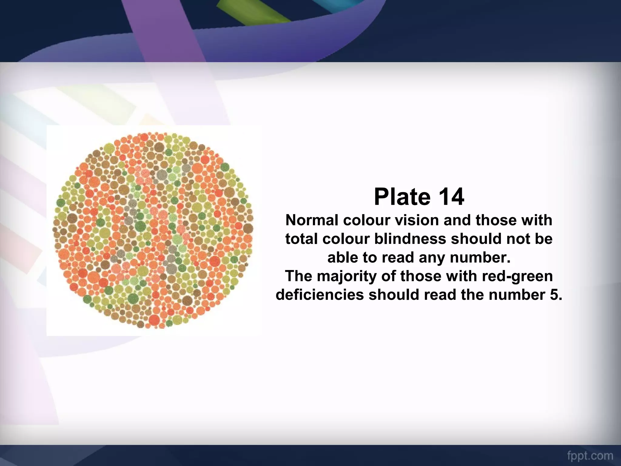 Prevalence of red green color vision defects | PPT