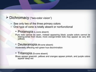 Chloropia Prevalence of red green color vision defects | PPT