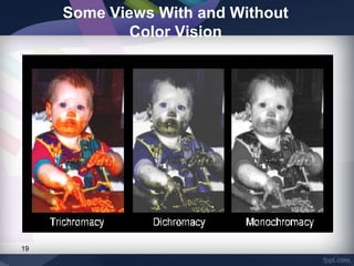 Chloropia Prevalence of red green color vision defects | PPT