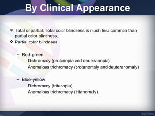 Chloropia Prevalence of red green color vision defects | PPT