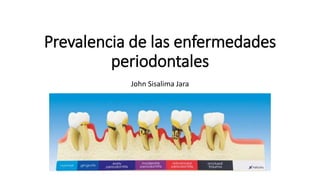 Prevalencia de las enfermedades
periodontales
John Sisalima Jara
 