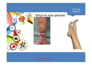 SÃO MAIS 
                       BONITAS?

Ouça as suas pernas!




ALDA LOPES PINTO
 