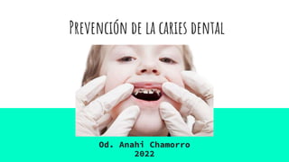 Prevención de la caries dental
Od. Anahi Chamorro
2022
 