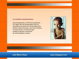 José María Olayo olayo.blogspot.com
La condición socioeconómica.
Aproximadamente, el 87% de la población
con algún tipo de discapacidad visual se
encuentran en países en vías de desarrollo,
donde la falta de acceso a servicios médicos,
la malnutrición y la falta de agua
potable propician la aparición
de enfermedades oculares.
 