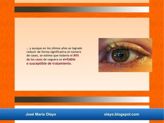 José María Olayo olayo.blogspot.com
… y aunque en los úlimos años se logrado
reducir de forma significativa el número
de casos, se estima que todavía el 80%
de los casos de ceguera es evitable
o susceptible de tratamiento.
 