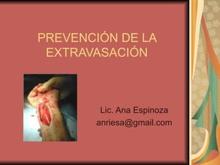 PREVENCIÓN DE LA EXTRAVASACIÓN Lic. Ana Espinoza [email_address] 