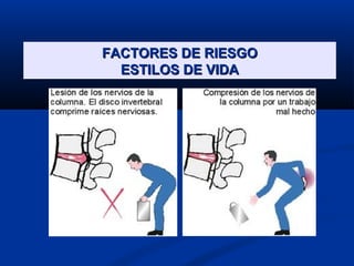 FACTORES DE RIESGOFACTORES DE RIESGO
ESTILOS DE VIDAESTILOS DE VIDA
 