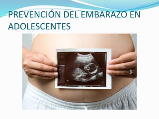 PREVENCIÓN DEL EMBARAZO EN
ADOLESCENTES
 