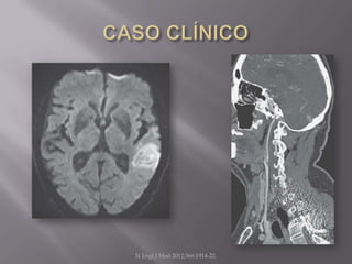 N Engl J Med 2012;366:1914-22.
 