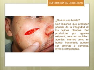 ENFERMERÍA EN URGENCIAS
¿Qué es una herida?
Son lesiones que producen
pérdida de la integridad de
los tejidos blandos. Son
producidas por agentes
externos, como un cuchillo o
agentes internos como un
hueso fracturado; pueden
ser abiertas o cerradas,
leves o complicadas.
 