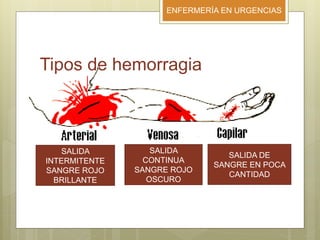ENFERMERÍA EN URGENCIAS
Tipos de hemorragia
SALIDA
INTERMITENTE
SANGRE ROJO
BRILLANTE
SALIDA
CONTINUA
SANGRE ROJO
OSCURO
SALIDA DE
SANGRE EN POCA
CANTIDAD
 