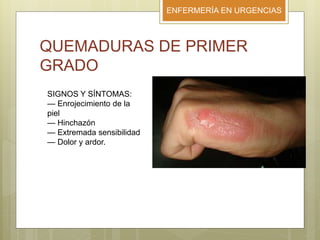 ENFERMERÍA EN URGENCIAS
QUEMADURAS DE PRIMER
GRADO
SIGNOS Y SÍNTOMAS:
— Enrojecimiento de la
piel
— Hinchazón
— Extremada sensibilidad
— Dolor y ardor.
 