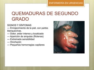 ENFERMERÍA EN URGENCIAS
QUEMADURAS DE SEGUNDO
GRADO
SIGNOS Y SÍNTOMAS
— Enrojecimiento de la piel, con partes
blanquecinas.
— Dolor, ardor intenso y localizado
— Aparición de ampulas (flictenas)
— Extremada sensibilidad
— Hinchazón
— Pequeñas hemorragias capilares
 