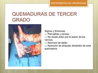 ENFERMERÍA EN URGENCIAS
QUEMADURAS DE TERCER
GRADO
Signos y Síntomas
— Piel pálida y serosa
— No existe dolor por la lesión de los
nervios.
— Necrosis de tejido
— Aparición de ampulas alrededor de esta
quemadura.
 